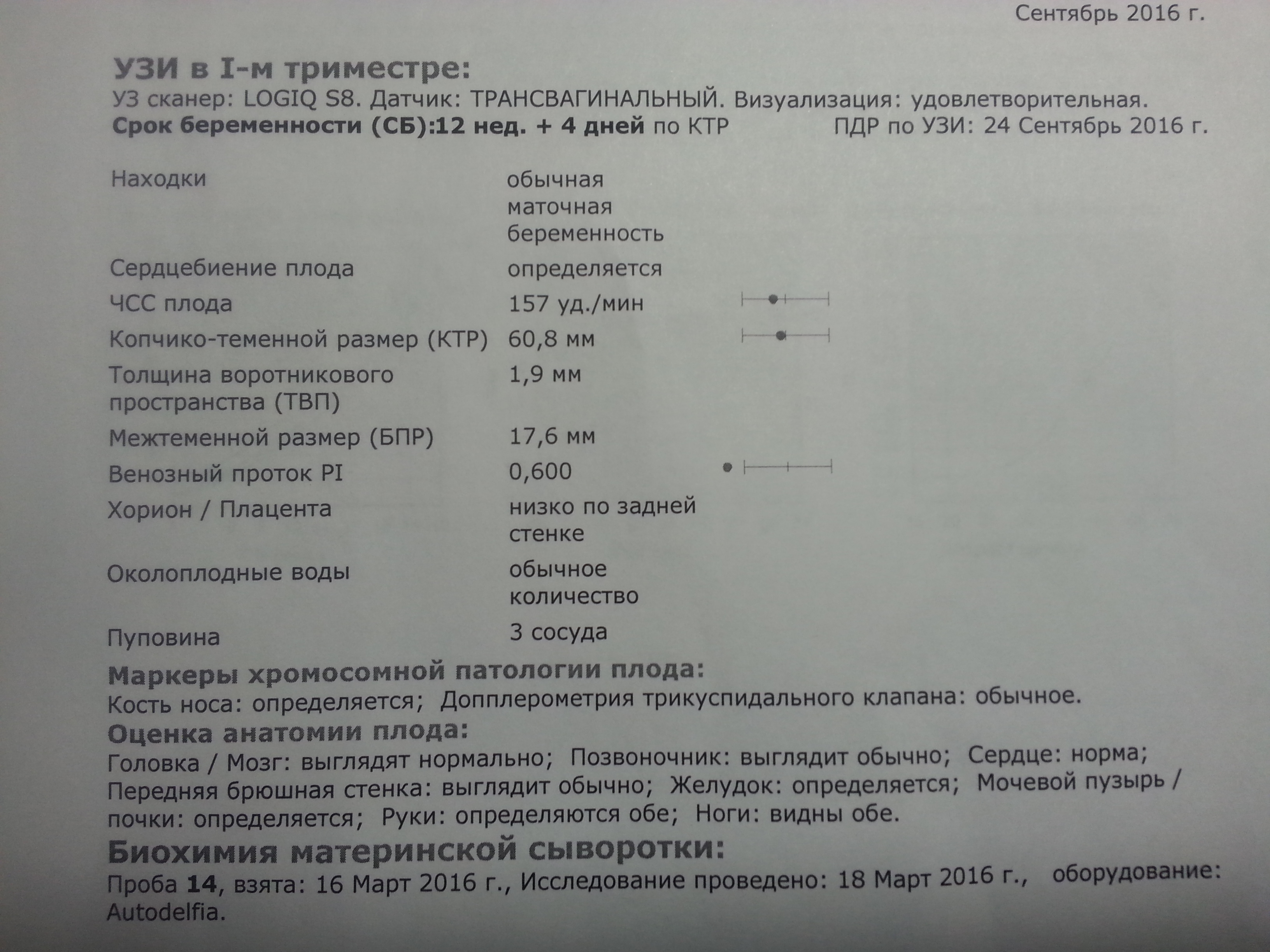 Не будет будильник что делать Не будет будильник что делать