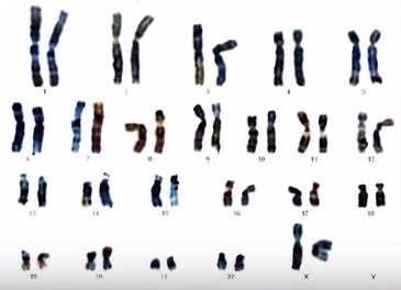 хромосомы.jpg