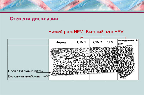 Плоскоклеточная метаплазия мочевого пузыря | Медицинский центр Уроклиник