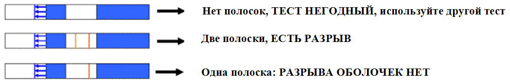 Околоплодные Воды Как Выглядят Фото