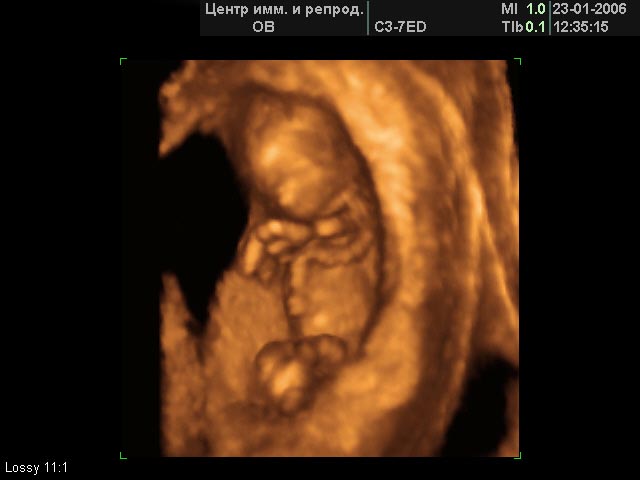 Шевеления на 12 неделе. Плод ребенка на 12 неделе беременности. 12 Недель беременности размер плода фото УЗИ. УЗИ 12-13 недель беременности.