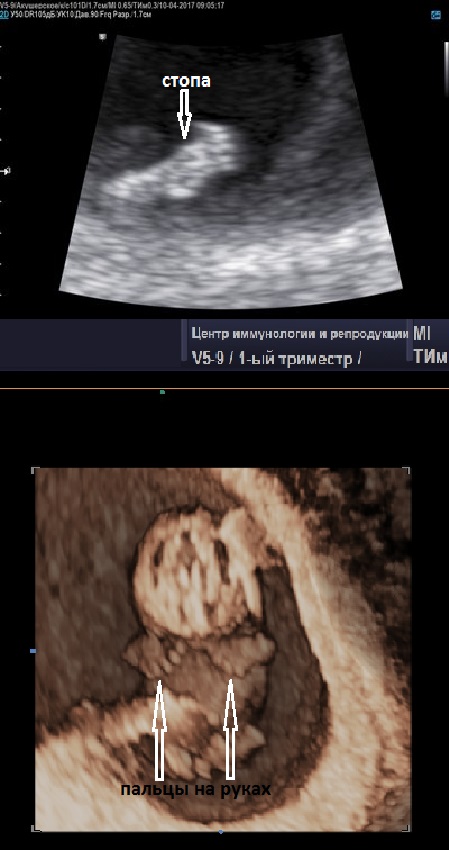 Ребёнок 14 недель беременности фото
