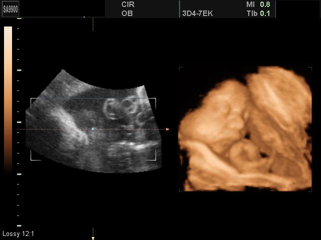 Узи 40 недель. УЗИ 16 недель беременности. 30 Недель беременности УЗИ плода. Снимки УЗИ на 16 неделе беременности. 16 Недель беременности фото плода на УЗИ.