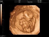 УЗИ фото при беременности, фото плода 2 триместр 14 недель