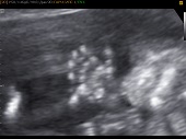 УЗИ фото при беременности, фото плода 2 триместр 16 недель