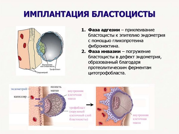 риск3.jpg