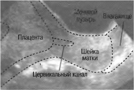 Пуповина – норма и патология