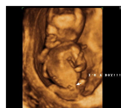 Беременная Мальчиком (6 Фото)