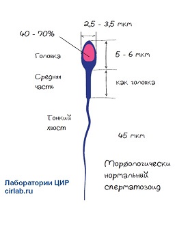 Морфология сперматозоида.jpg