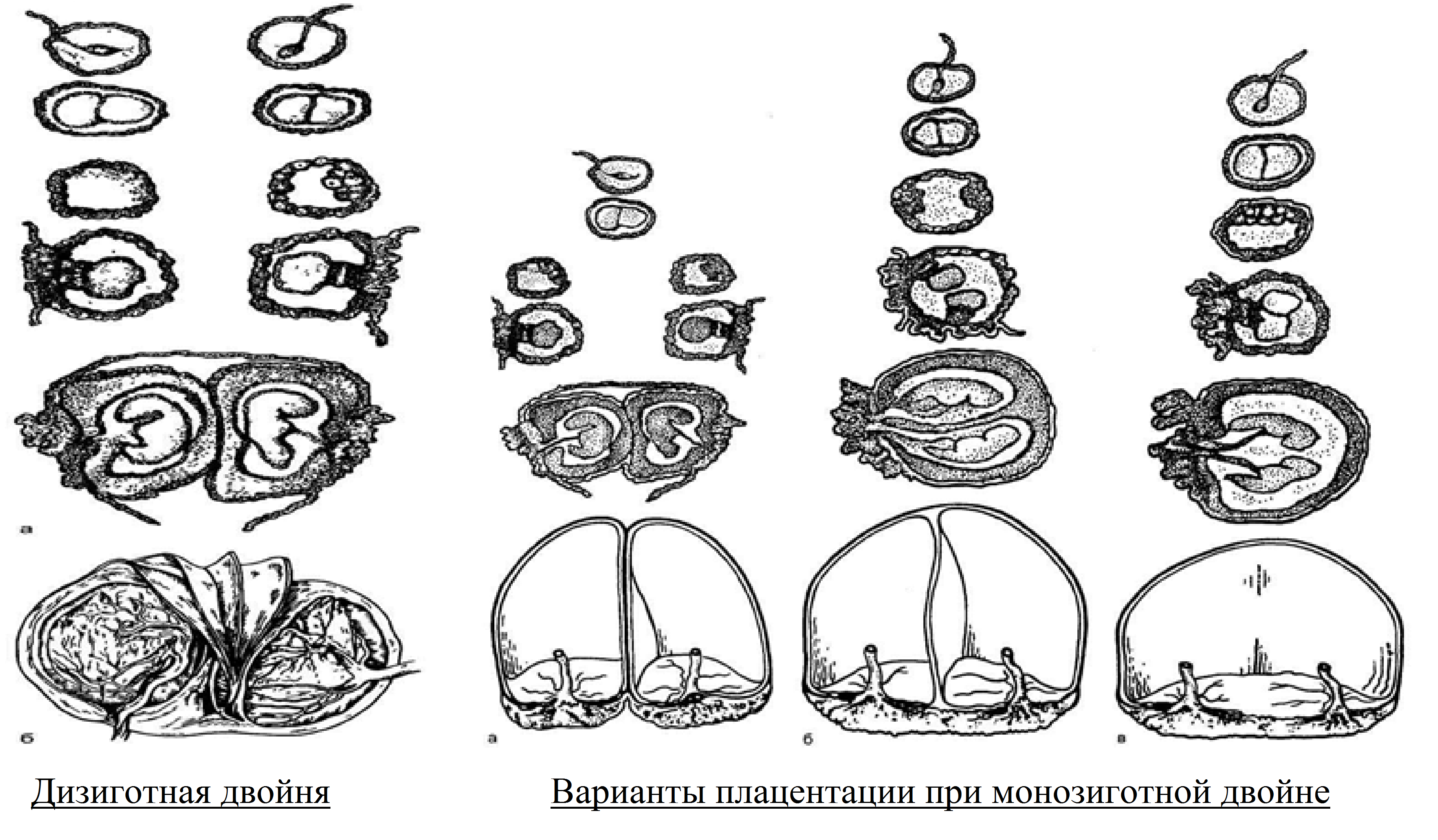 Развитие Двойни По Неделям Беременности Фото