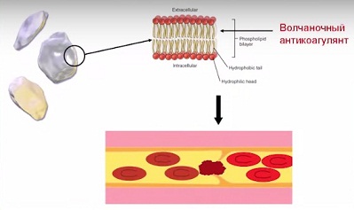 волчаночный антикоагулянт.jpg