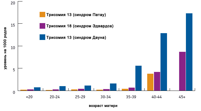 Расщелина губы и синдром дауна