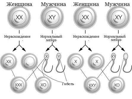 Синдром трисомия по x хромосоме